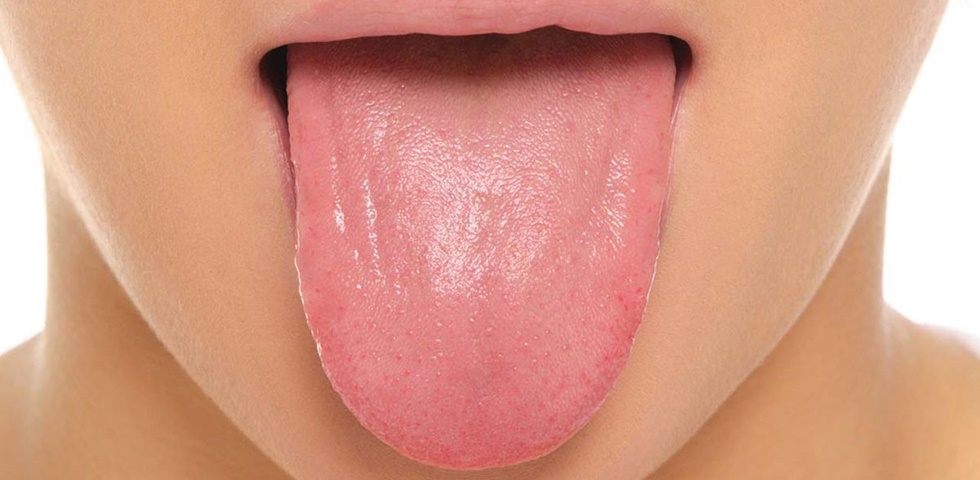 A nyelvnek is van orra?